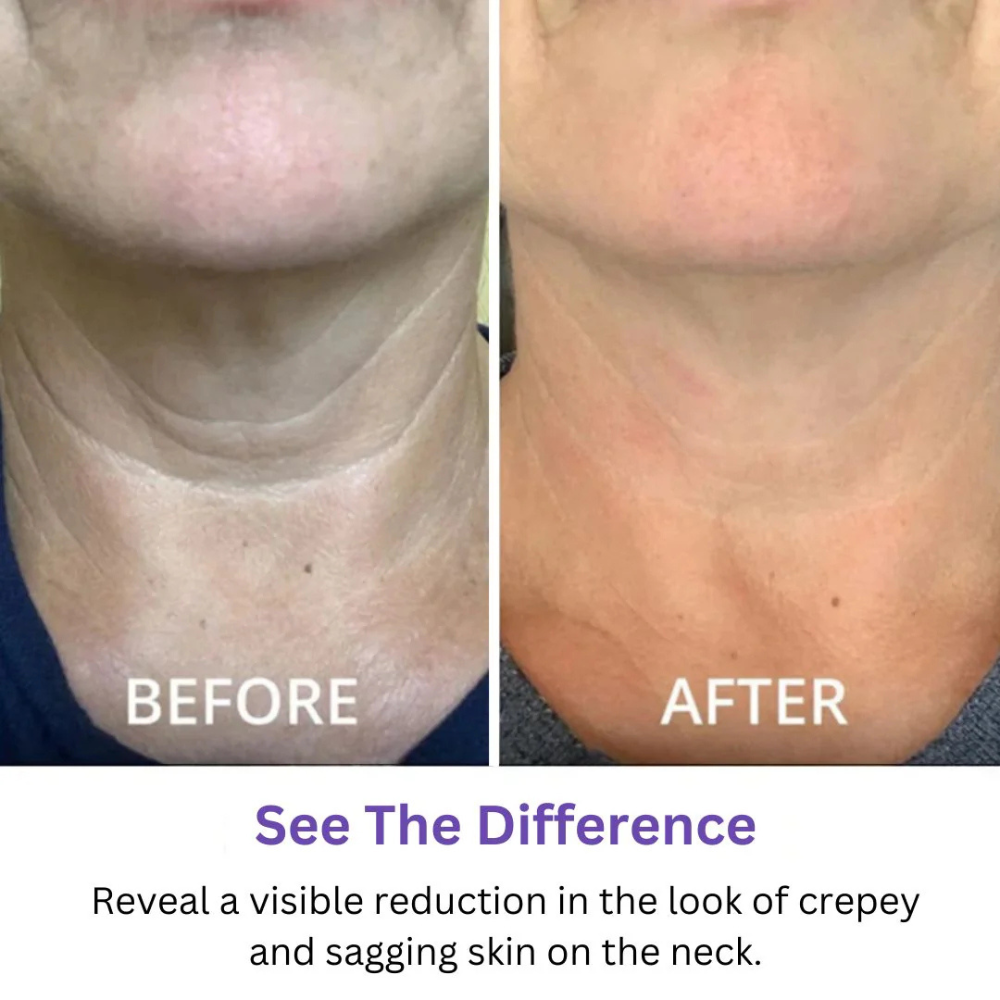 Tighten and Lift Neck Cream